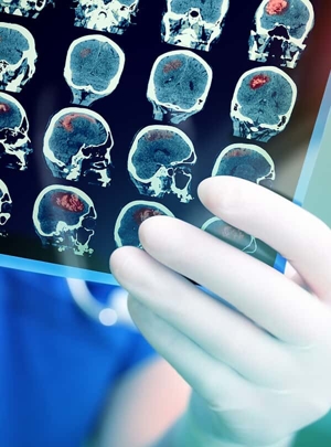 Catastrophic injury Image