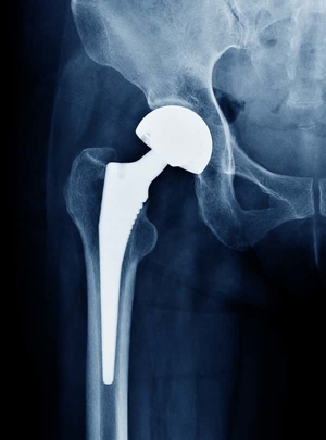 Dangerous & defective medical devices Image